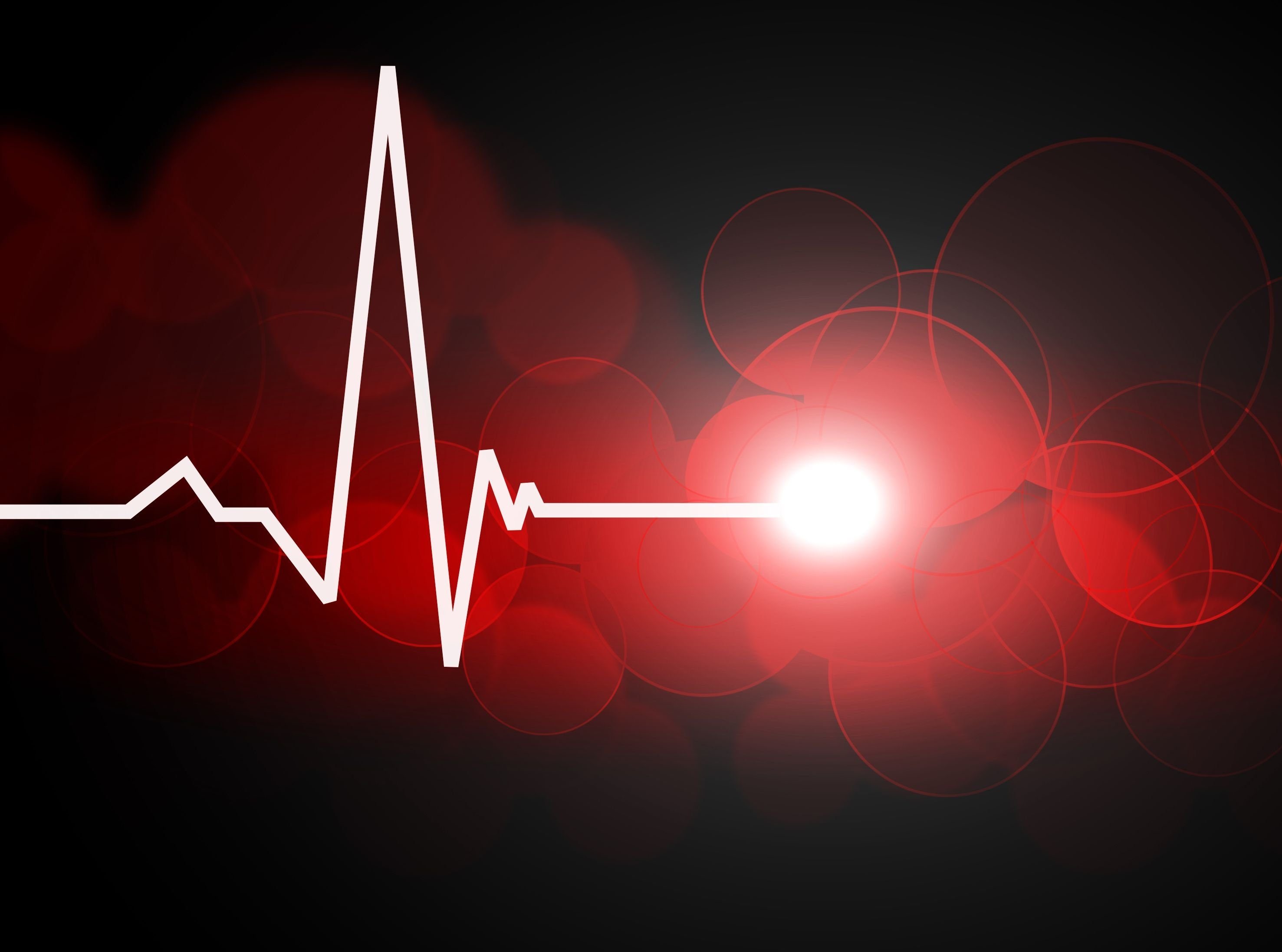 Пульс остановился. Кардиограмма сердца. Пульс. Сердцебиение кардиограмма.